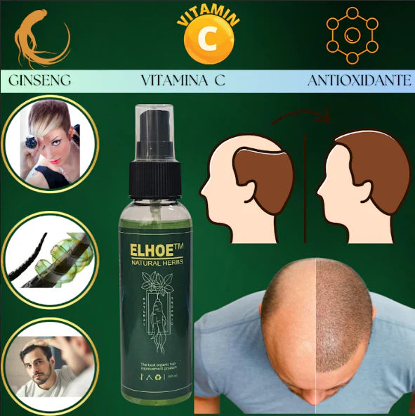 SUPER TÓNICO PARA CABELLO ELHOE